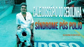 A SINDROME POS POLIO POR CEBOLINHA