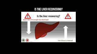 Is the liver recovering? #cirrhosis #liver #transplante #livercirrhosis