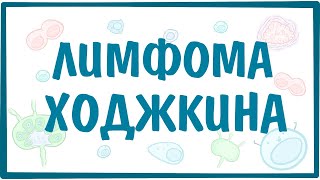 Лимфома Ходжкина (Лимфогранулематоз) — причины, симптомы, патогенез, диагностика, лечение