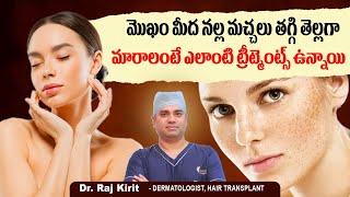 How to Remove Melasma from Face Naturally in Telugu || How to Remove Melasma Permanently | Celestee