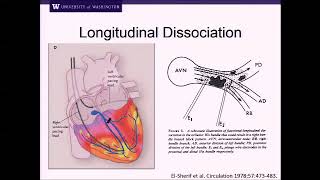 Update on Pacemakers and ICDs: Leaded and Unleaded