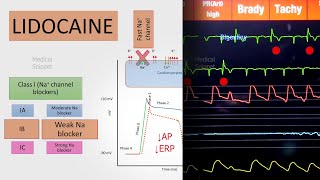 Lidocaine mechanism of action | Class IB Antiarrhythmic agent