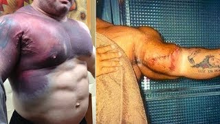 Top 5 Bodybuilders Whose Muscles Exploded