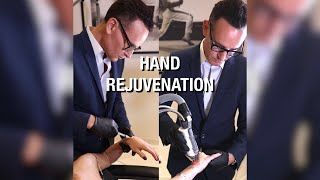 Hand Rejuvenation at PFRANKMD