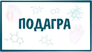 ПОДАГРА — причины, симптомы, патогенез, диагностика, лечение