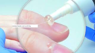 cuticle remover