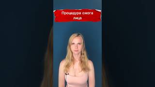 Смас лифтинг стоит ли делать? #оваллица #смаслифтинг #подтяжкалица