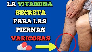 🚨 ¡La VITAMINA SECRETA 🚨 Disuelve los COÁGULOS de Sangre DE TUS PIERNAS