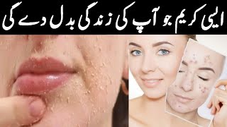 skin a cream uses in urdu | rang gora karne wali cream | best skin whitening cream | acne treatment