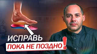 ПЛОСКОСТОПИЕ - что это? Какие ОПАСНОСТИ ждет организм? Диагностика и лечение плоскостопия