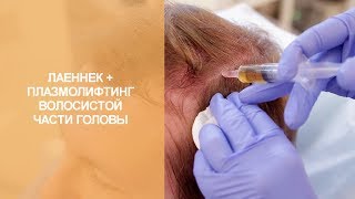 Лаеннек + плазмалифтинг волосистой части головы