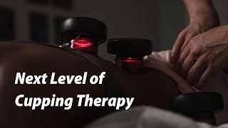 OMG ! The Best CUPPING THERAPY Ever !