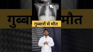 Gubbare Se Bache Ki Hui death Dekho Video #knowledge #facts #motivation