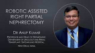 Robotic Assisted Right Partial #Nephrectomy (#KidneyCancer #Surgery) by Dr Anup Kumar