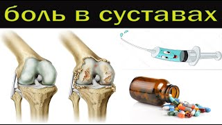 Таблетки для снятия боли в спине и суставах.