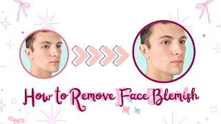 How to Remove Face Blemishes? | AVCLabs PhotoPro AI