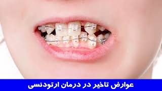 عوارض تاخیر در ارتودنسی | دکتر احسان ابویی مهریزی