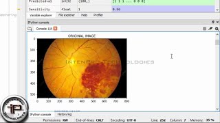 Diabetes Retinopathy Image Segmentation and Classification in Fundus Image using SVM In PYTHON - DIP