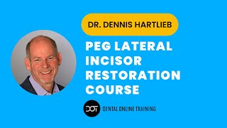 Peg Lateral Incisor Restorations | Dr. Dennis Hartlieb | Dental Online Training