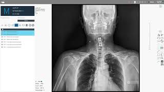 Full Spine Stitching - GoDR Digital X-ray Software from JRX Diagnostics