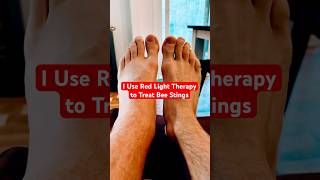 How RED LIGHT THERAPY Transformed My Recovery! #RedLight