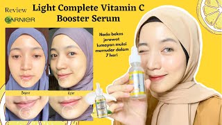 Cara Mencerahkan Noda Bekas Jerawat Pake Garnier Light Complete Vitamin C Booster Serum 👍🏻