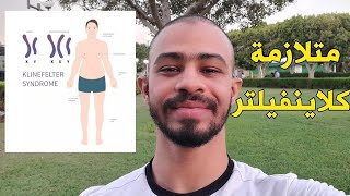 متلازمة كلاينفيلتر (اسباب، اعراض، تشخيص، علاج) - دواك موجود