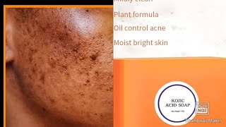 How to properly useKojic Acid Soaps to clear dark spot,elbow dark underarm and brighten the ski