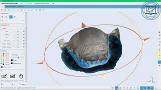 2020-12 Maestro easy aligner set-up with cbt roots