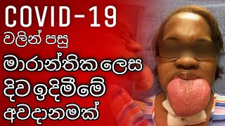 COVID Tongue: Here’s All You Need To Know About The Latest Coronavirus Symptom | SINHALA.