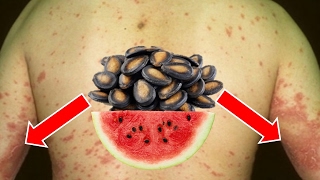 Take Watermelon Seeds and Boil Them The Results Will Shock You