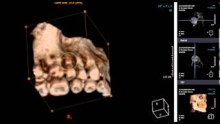 cbct del cranio 3d