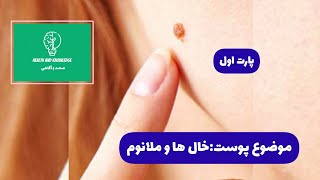 #پوست🔸 خال و ملانوم۱  ( ویژه محصلین  و دانشجویان)