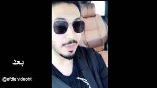 ممدوح الشمري يسب ويقذف المغردين - شاهد ممدوح قبل وبعد الشهره