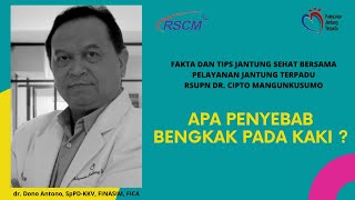 Apa Penyebab Bengkak Pada kaki? oleh dr. Dono Antono, SpPD-KKV, FINASIM, FICA