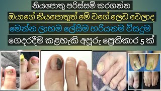 නියපොතු පරිස්සම් කරගන්න/ඔයාගේ නියපොතු මේ වගේ ලෙඩ වෙලාද/ගෙදරදීම ප්‍රෙතිකාර Tue nail fungus treatments