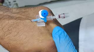 وانەی بیست و شەش(٢٦ب): وانەی کرداری کانۆلادانان Intravenous cannulation procedure