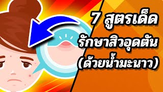 📌😍 7 วิธี มะนาวรักษาสิวอุดตัน (ทำเองได้) สิวหายเร็ว