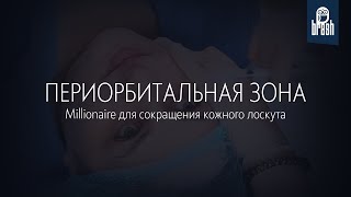 Millionaire для коррекции периорбитальной области: сокращаем кожный лоскут и уплотняем