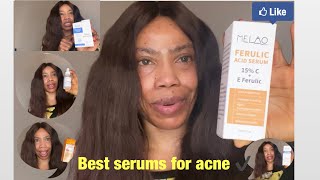 The ordinarys and Melao skincare updates reviews #acne #melao #serum #theordinary #reviews #Ruchi