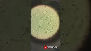 Germ tube test| candida albicans| fungal spore | Clinical microbiology| Reynolds -Braude phenomenon