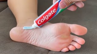 Put TOOTHPASTE on Your FEET - You Won't Believe the Results the Next Day! - USEFUL HOME TIPS