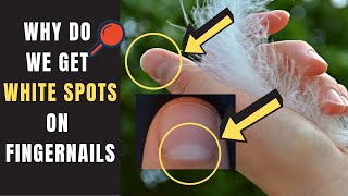 Interesting facts with reasons (Scientifically Proved) 2019 | Why White spots on finger nails