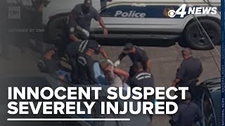 Video shows man suffer third degree burns during Phoenix arrest