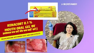 Kenacort 0.1 %mouth oral gel का इस्तेमाल कब करें और कब नहीं  करें ||