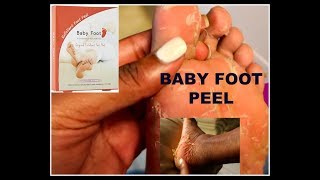 INSANE BABY FOOT PEEL