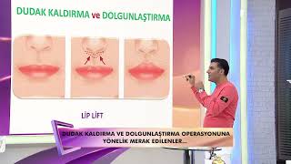 Lip lift ile Dudak kalınlaştırılabilir mi? Kalıcı olur mu?