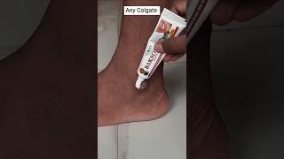 • Viral Video | Dark Feet Cleaning Tips | Clean Feet Dirt & Tanning Permanently#beauty #shorts #diy