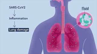 How COVID 19 Affects Your Lungs