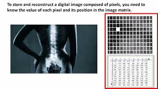 Digitizing Medical Images